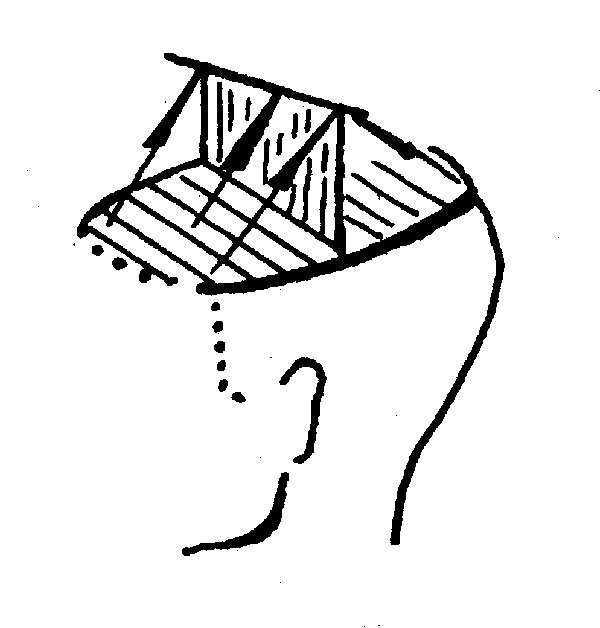Стрижка по типу шапочки - схема